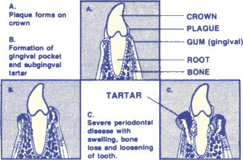 dental